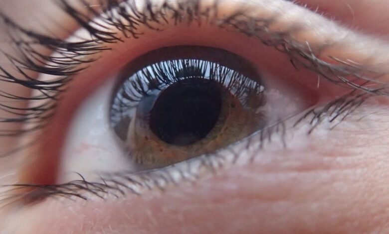 can you see what